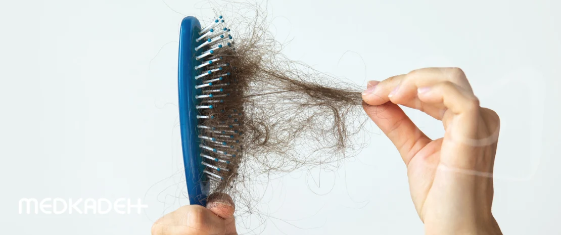 انواع ریزش مو