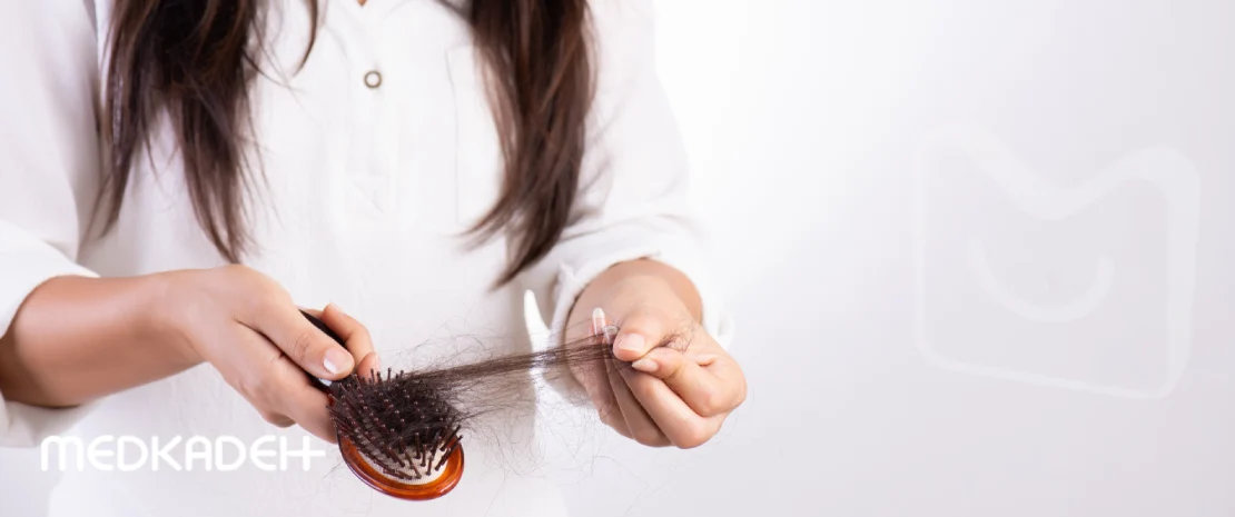 ریزش سکه ای مو