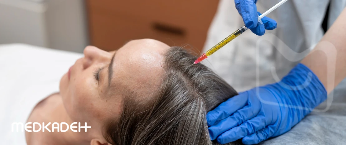 مزوتراپی مو