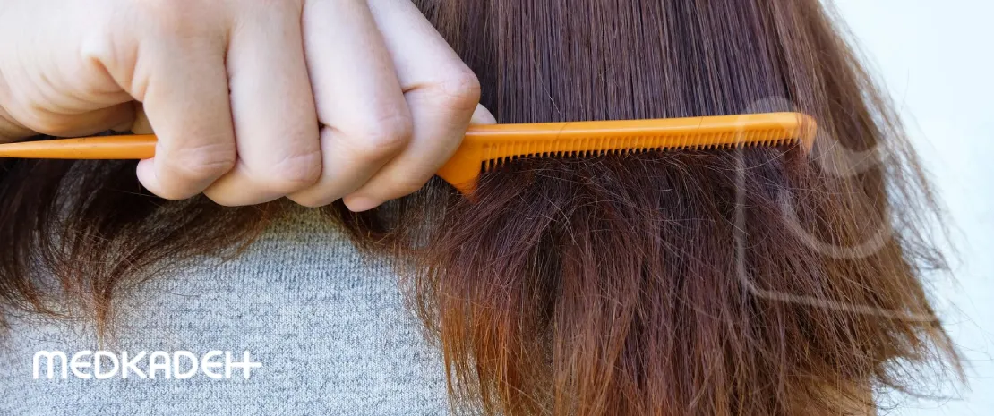 موخوره چیست (1)