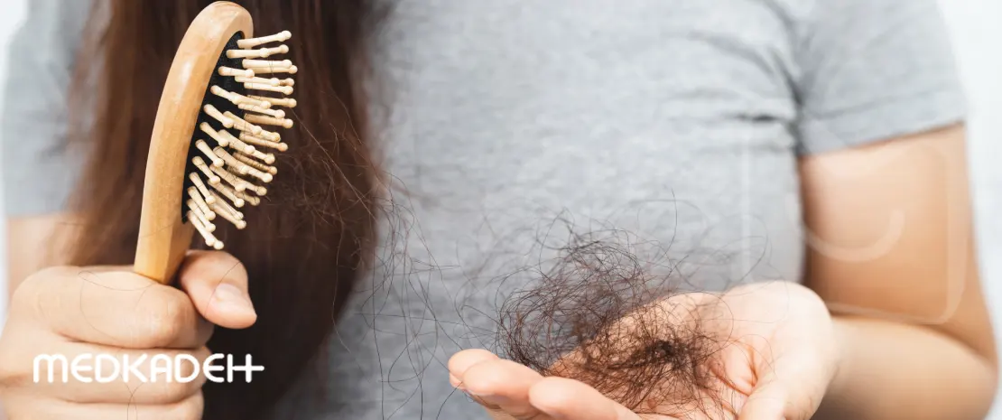 چگونه استرس باعث ریزش مو می_شود؟