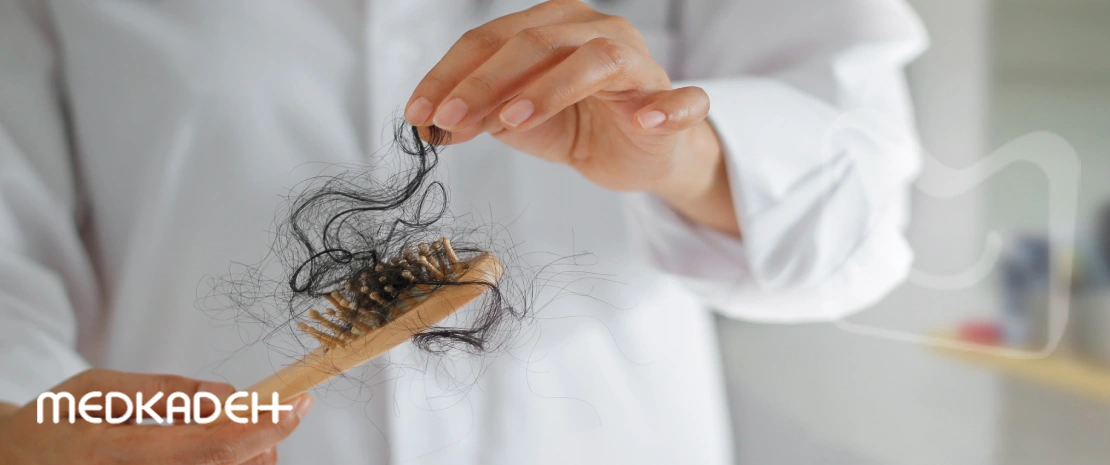تاثیر استرس بر ریزش مو