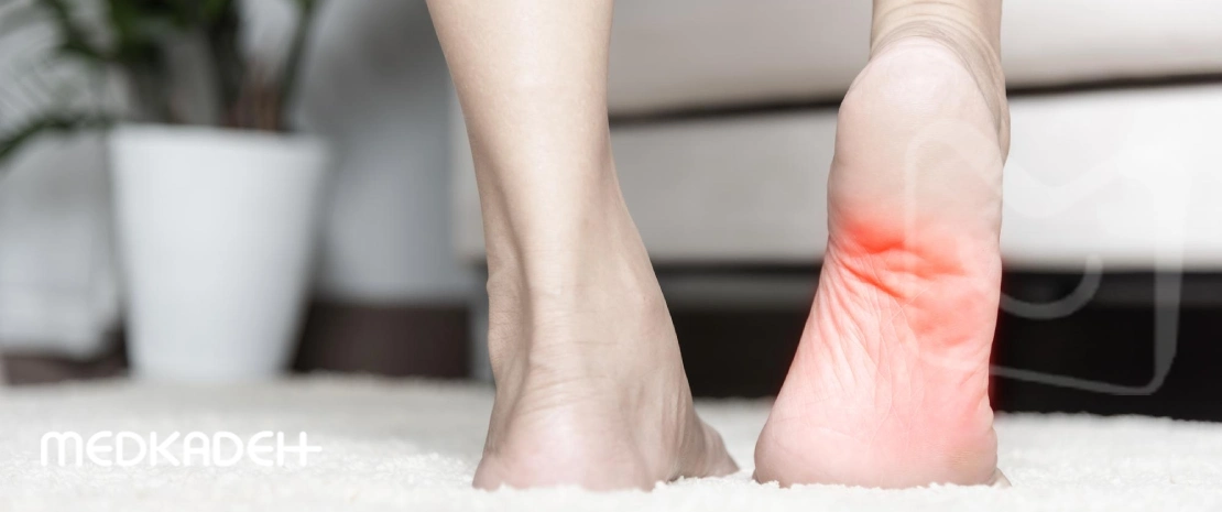 علائم خار پاشنه