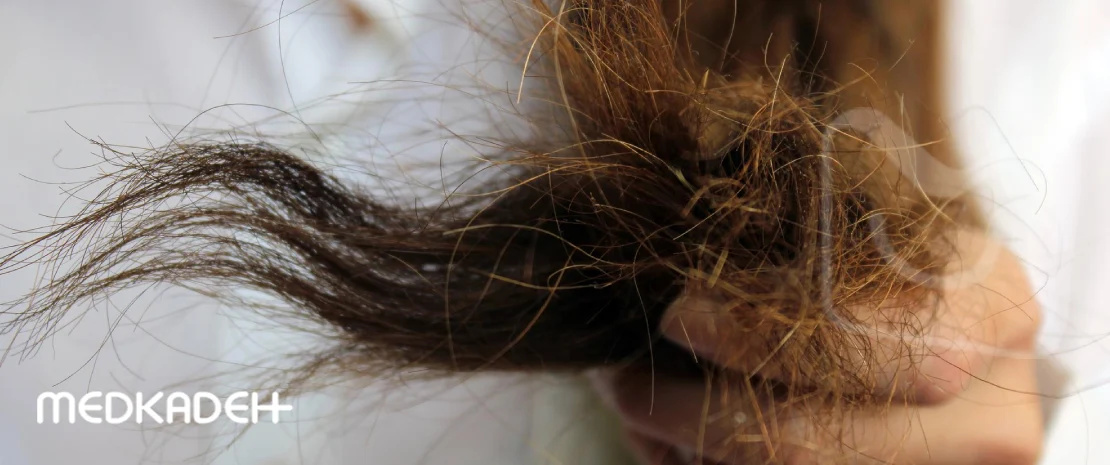 درمان خشکی مو