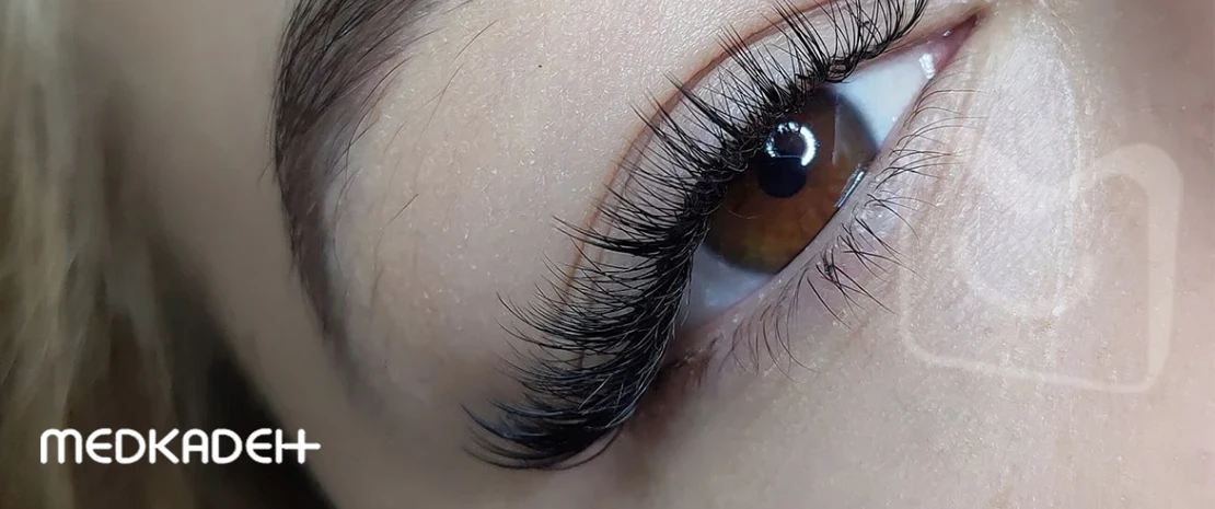 کاشت مژه چشم گربه ای