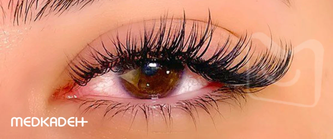 مژه چشم گربه ای