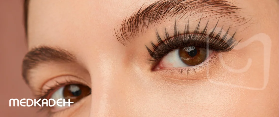 مدل کاشت مژه هیبریدی