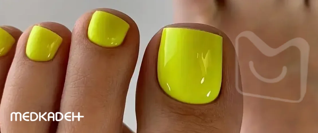 رنگ ناخن تابستانه