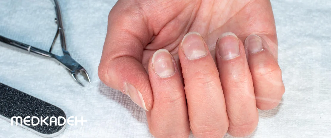 مراحل ریموو ناخن در منزل