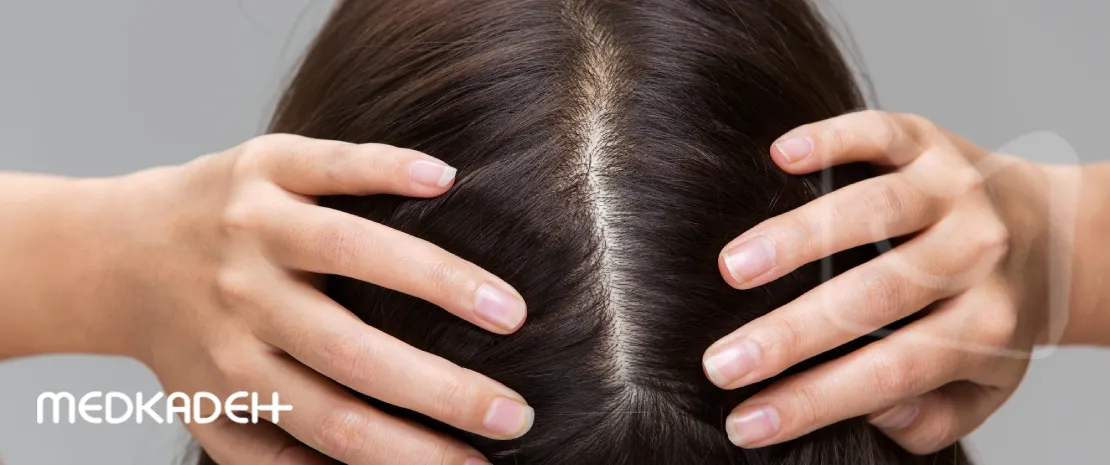 نحوه تشخیص جنس مو