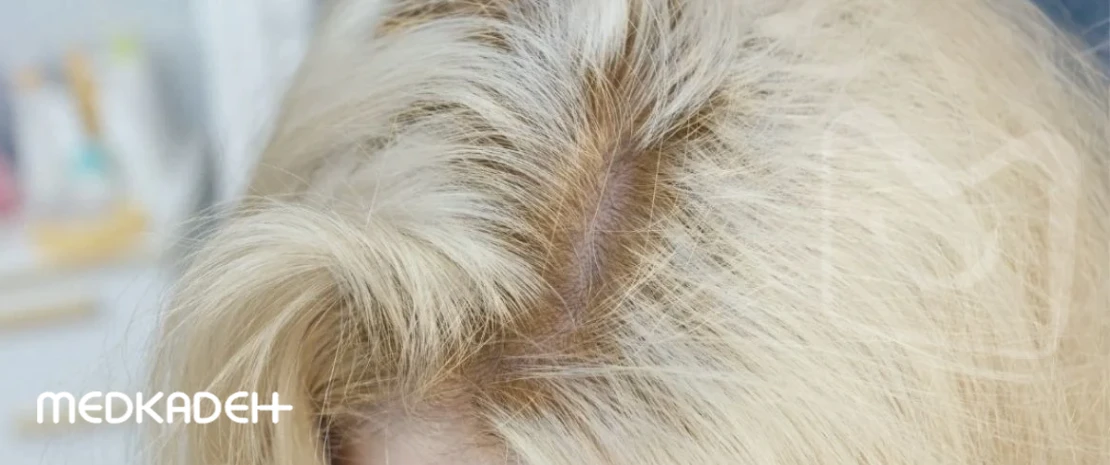 علت دو رنگ شدن مو بعد از دکلره