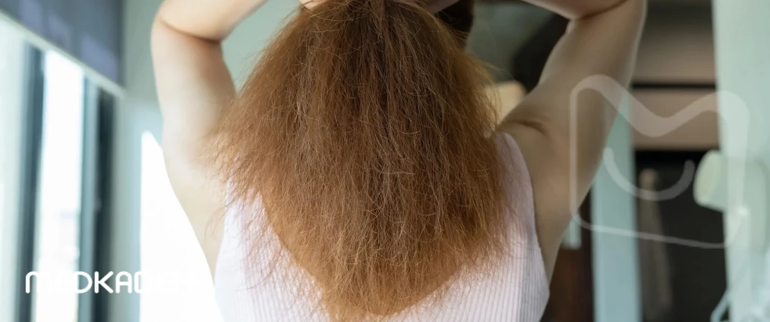 علت وز شدن مو