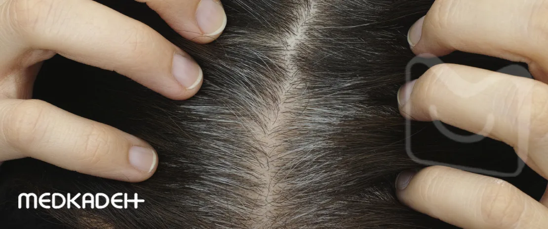 راه های جلوگیری از سفیدی مو