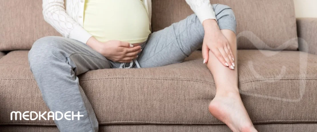 واریس در دوران بارداری