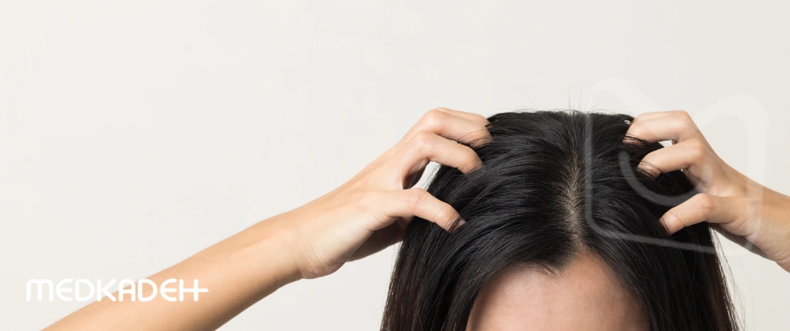 علل درد ریشه مو