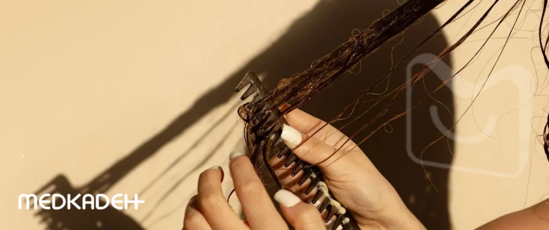 علت گره خوردن مو